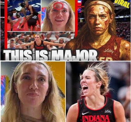 A SHOCKING HEAD-ON COLLISION COULDN’T STOP HER. Lexie Hull of the Indiana Fever suffered a nasty head injury after colliding with an opponent, leaving a huge knot on her forehead.