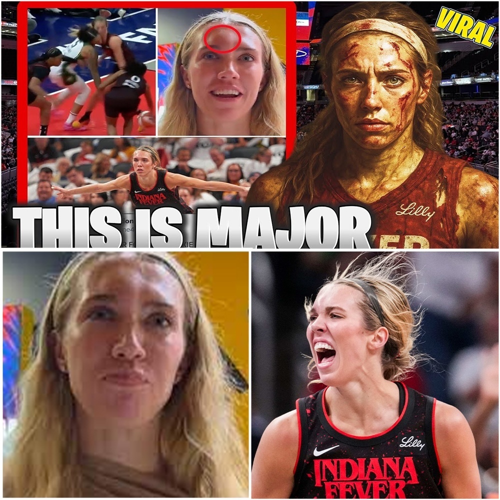 A SHOCKING HEAD-ON COLLISION COULDN’T STOP HER. Lexie Hull of the Indiana Fever suffered a nasty head injury after colliding with an opponent, leaving a huge knot on her forehead.